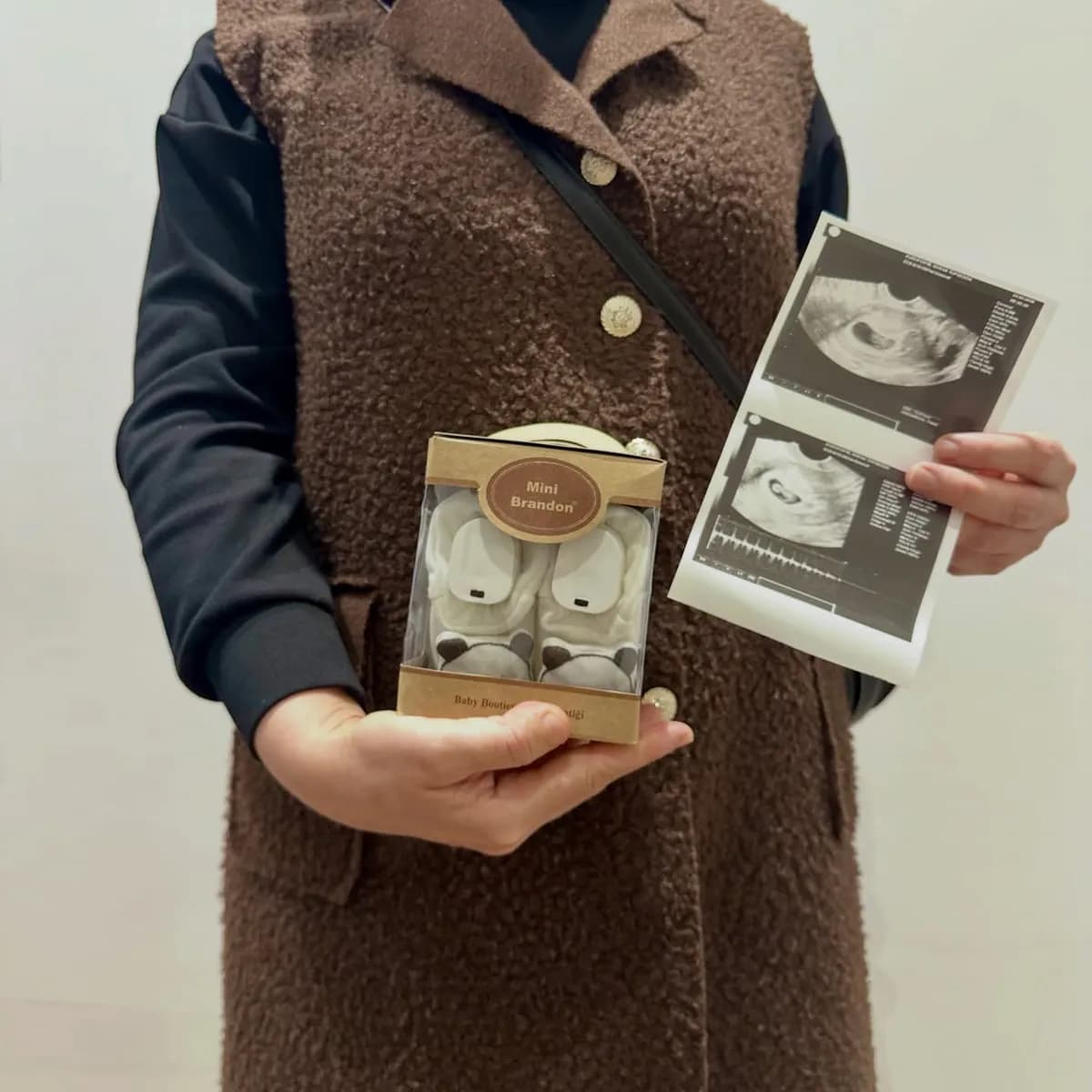 Bursa Eurofertil Tüp Bebek Merkezi, clínica de fertilidad en Bursa, Turquía — foto 4